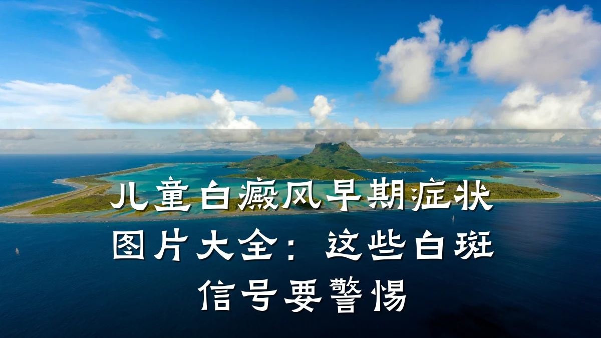 儿童白癜风早期症状图片大全:这些白斑信号要警惕
